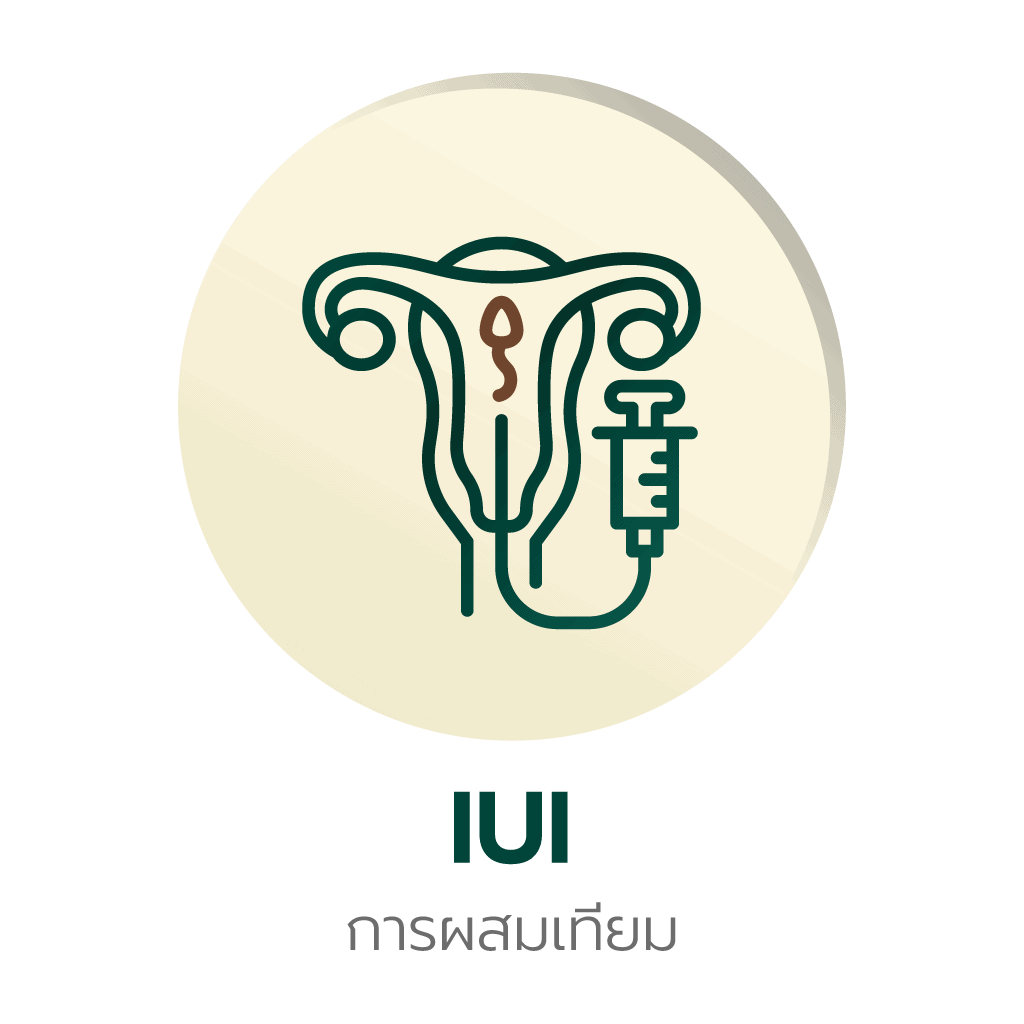 iui คือ